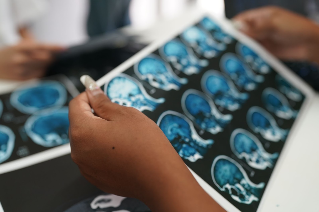 brain SPECT scan take