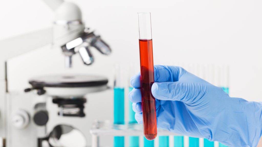 What Causes Blood to Thin