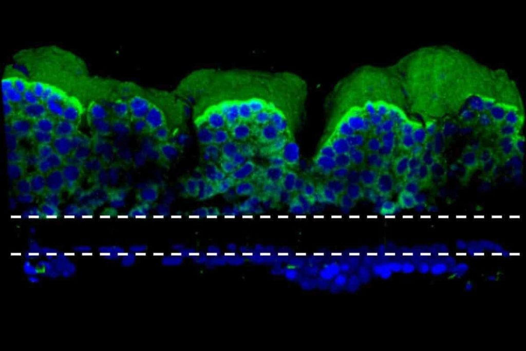 Real Radiation Effects on Human Body: 8 True Cases